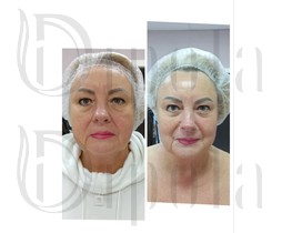 photo_2026-03-08_10-04-51