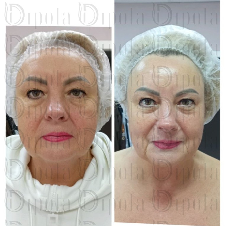 photo_2026-03-08_10-04-51